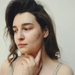 Close-up portrait of a woman with visible acne and natural beauty in soft lighting.